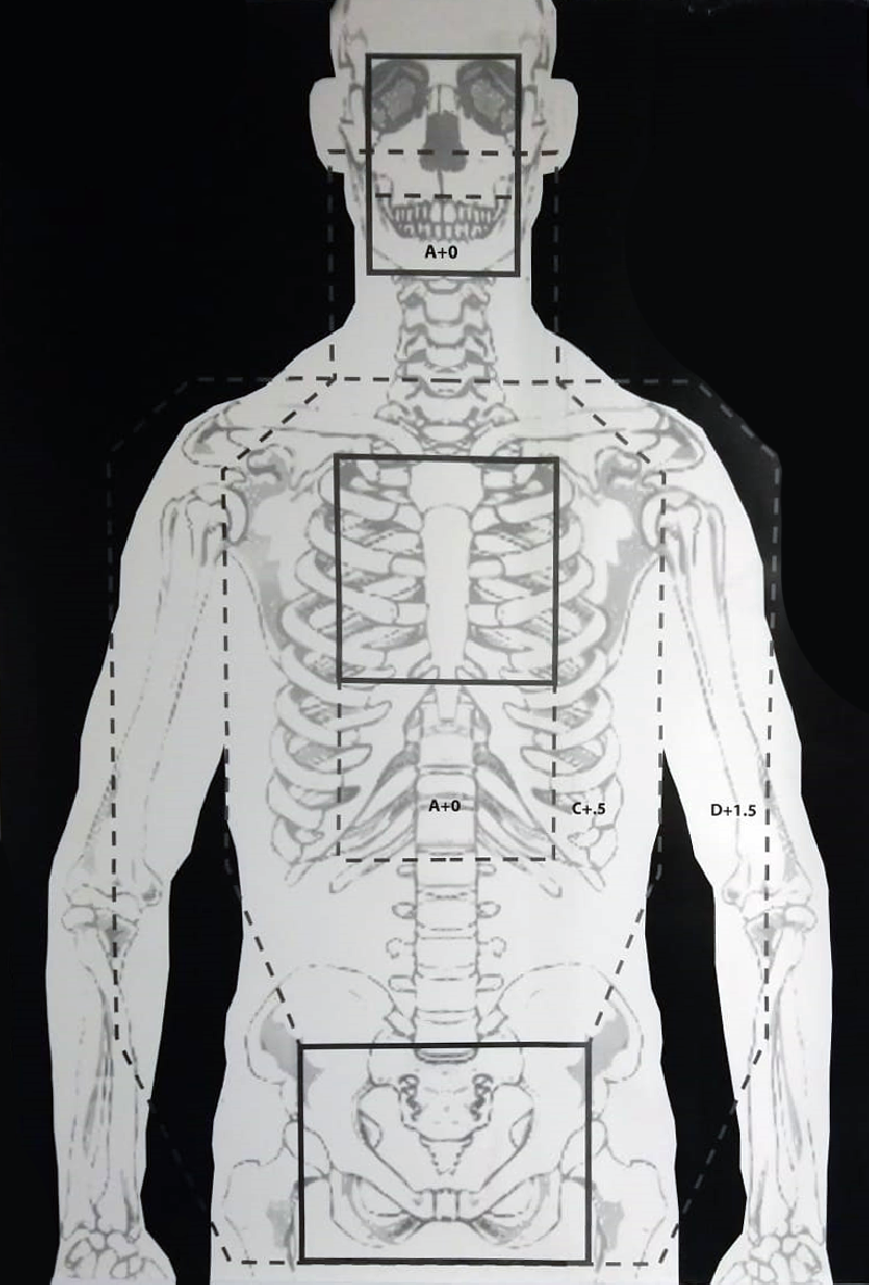 SKELETON